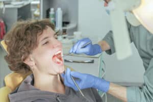 Treating Burned Gums from Teeth Whitening Treatment